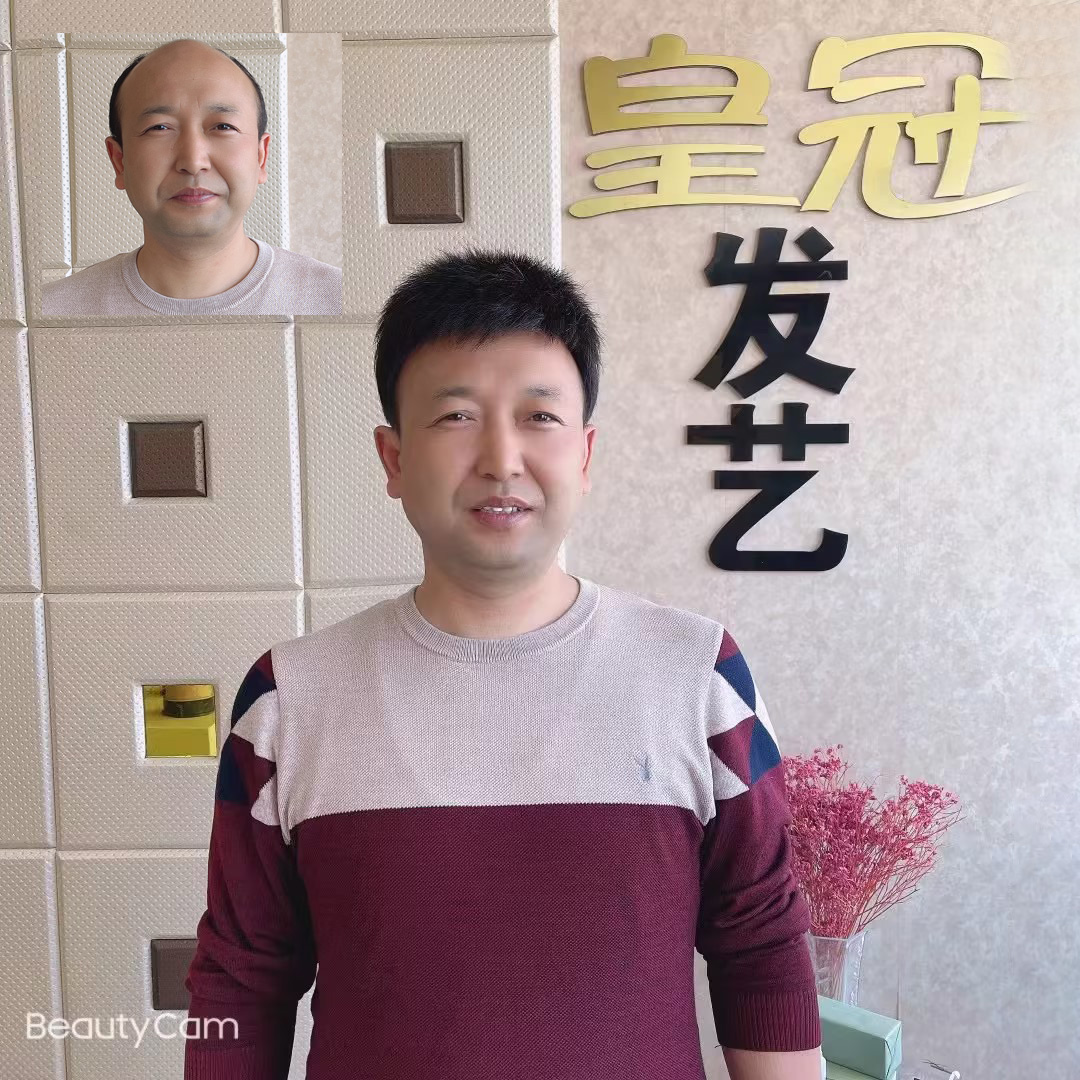 男士假发案例